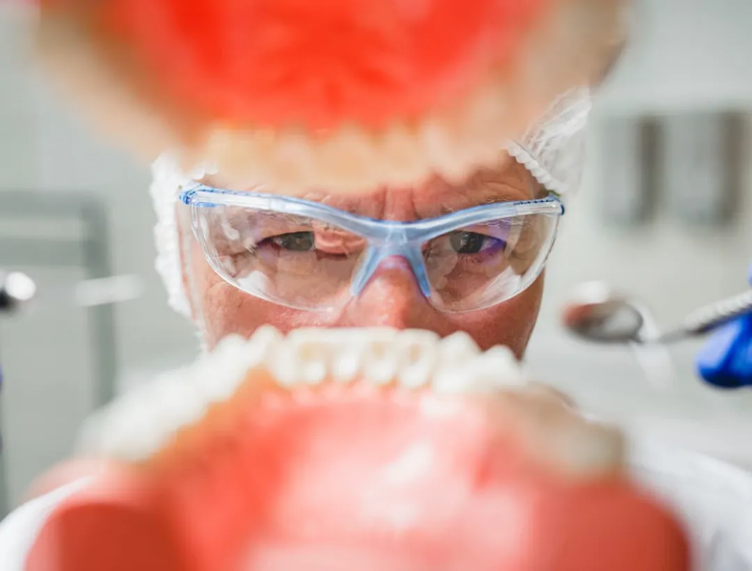 dental fillings and inlays