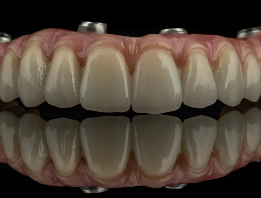 bone grafting procedure