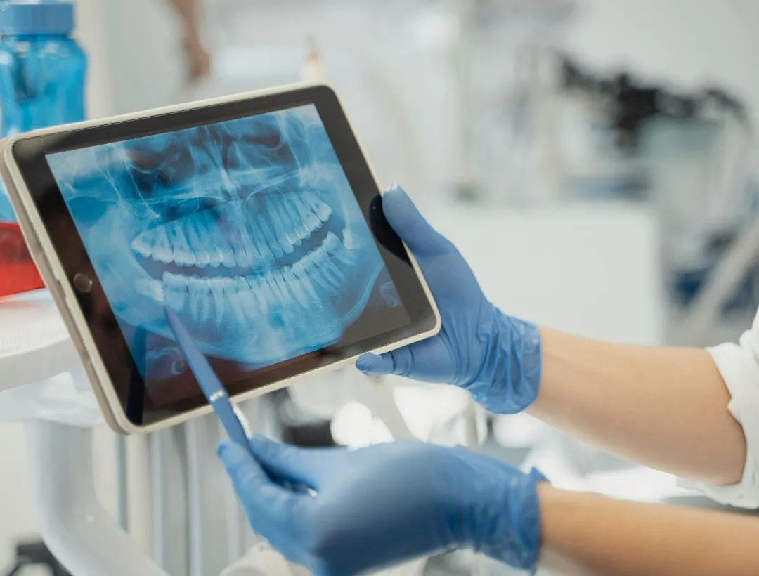 intraoral scanner (26)