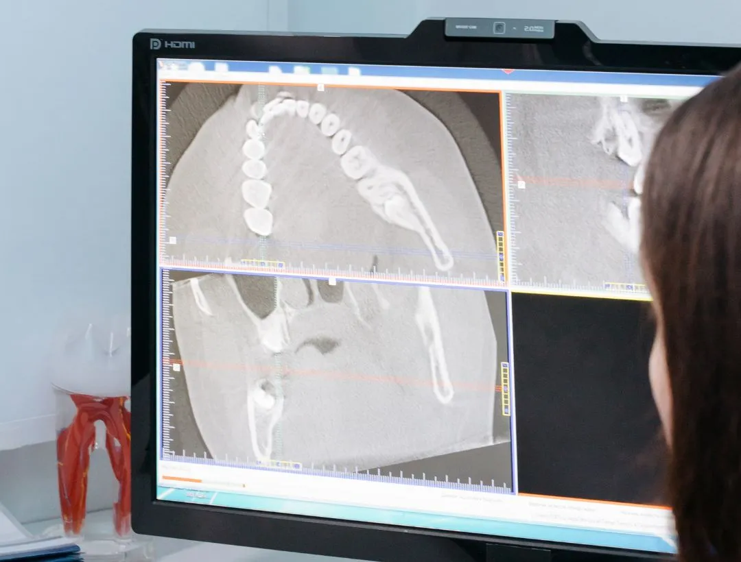 intraoral scanner (27)