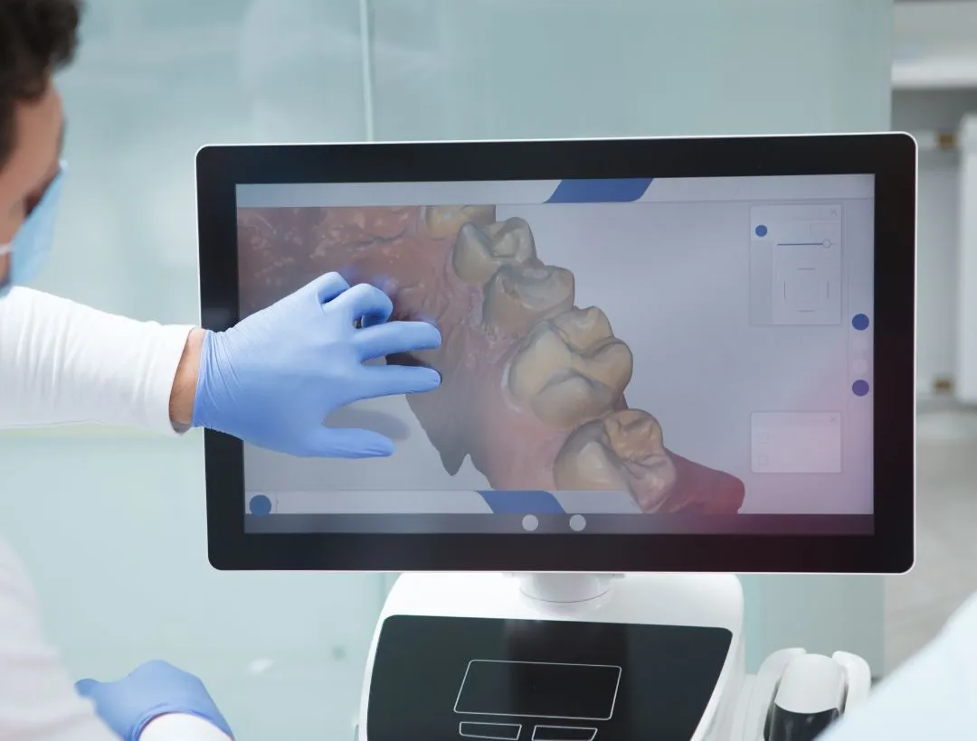 intraoral scanner (28)