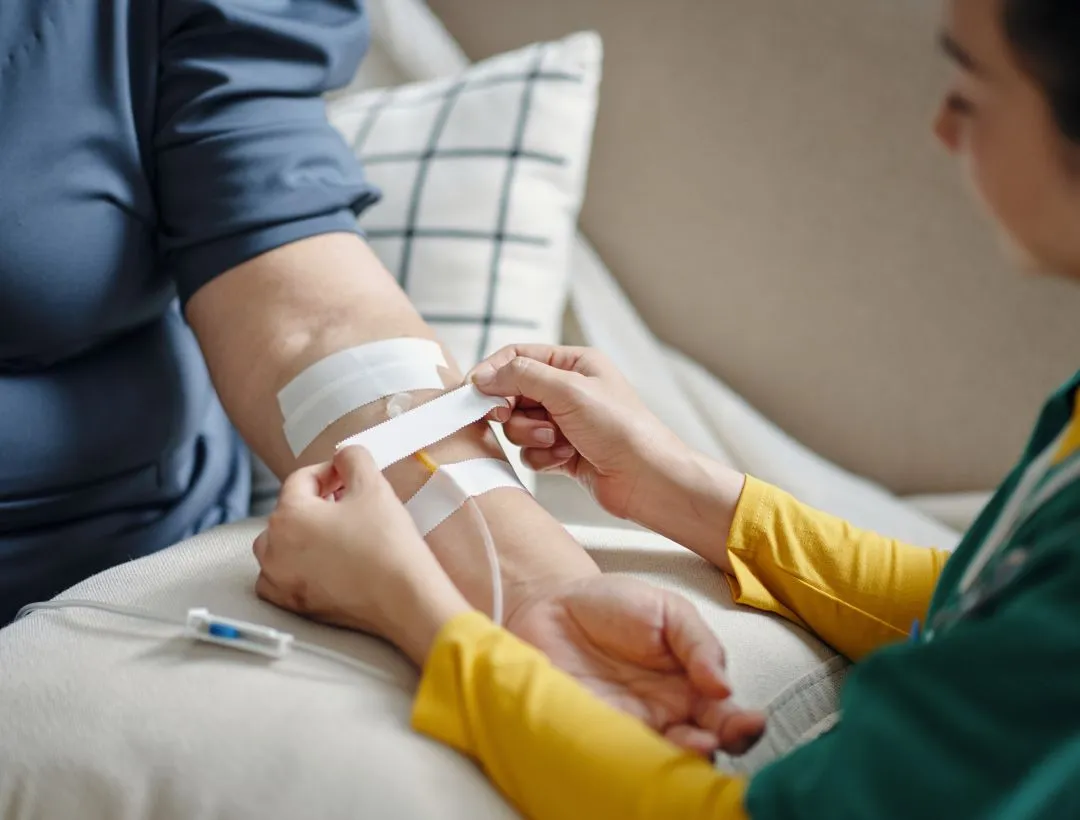  iv conscious sedation