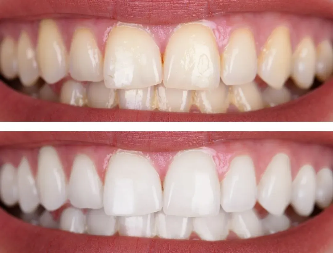 placeholder b a 2 (1)